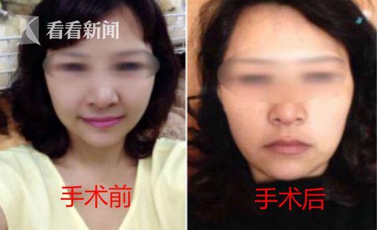 裸体女子医院大厅静坐抗议:隆胸丰脸完全没效果