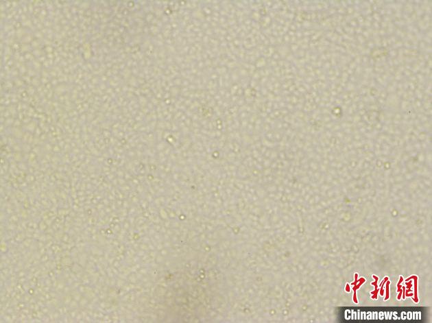 广东分离到广东首株新型冠状病毒毒株